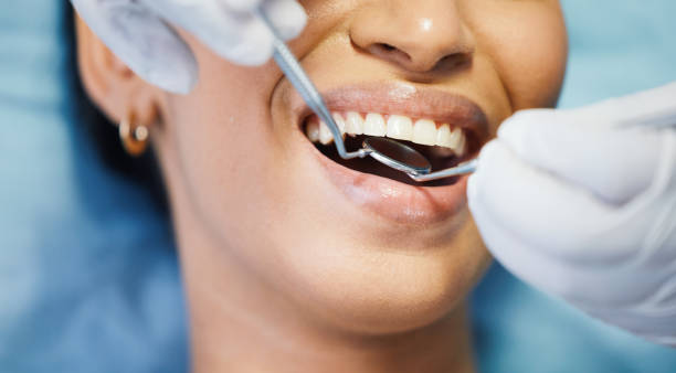Best Same-Day Emergency Dentist in Gratton, VA