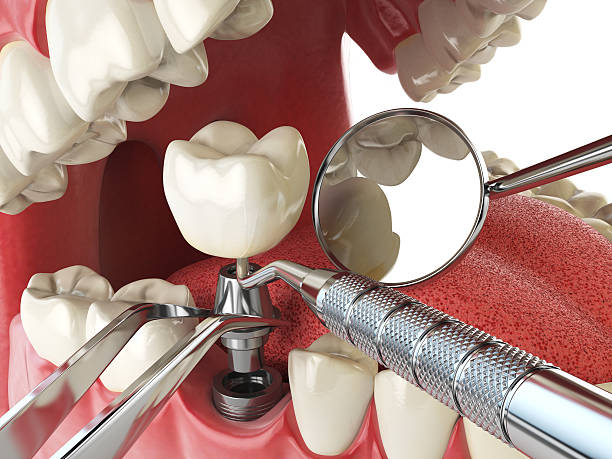 Best Emergency Treatment for Toothache in Gratton, VA